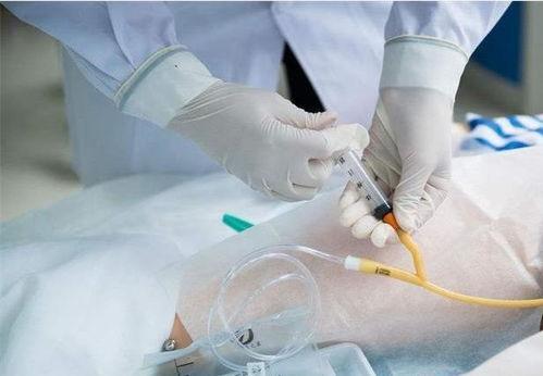 女士插尿管的视频,专业护理操作全解析